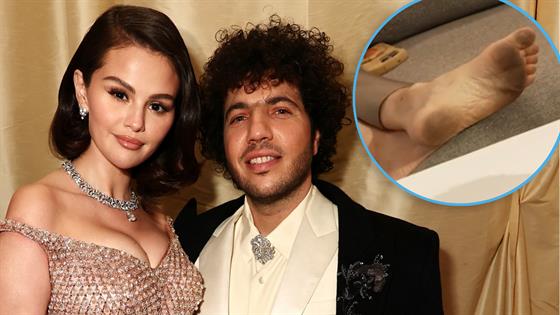 Benny Blanco Showing Off His Dirty Feet on Camera Has the Internet Crashing Out