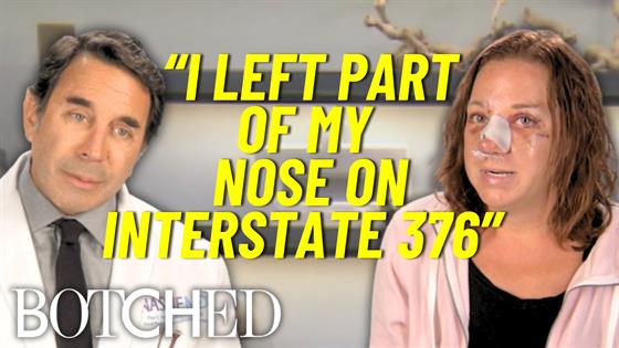 Dr. Nassif Transforms Jennifer's Nose After 175-Yard Car Accident